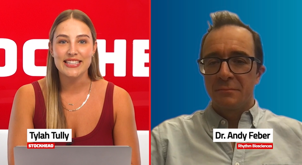 Stockhead with Rhythm Biosciences: Peer-reviewed validation for ColoSTAT